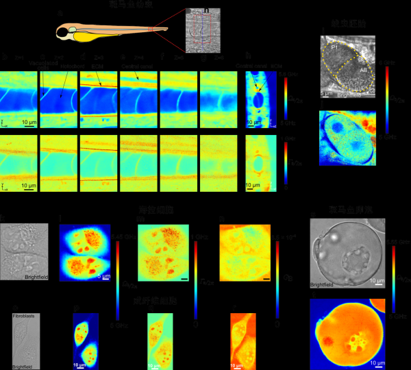 配资手机平台 我国成功研制全球首台高时空分辨布里渊显微镜：首次亚毫秒、亚微米